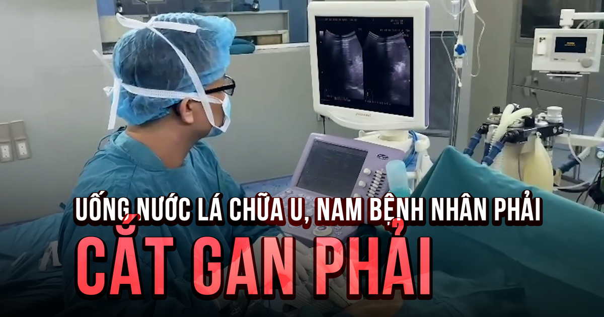 Uống thuốc lá chữa u ở gan, nam bệnh nhân phải cắt toàn bộ gan phải vì u có kích thước 'khổng lồ'