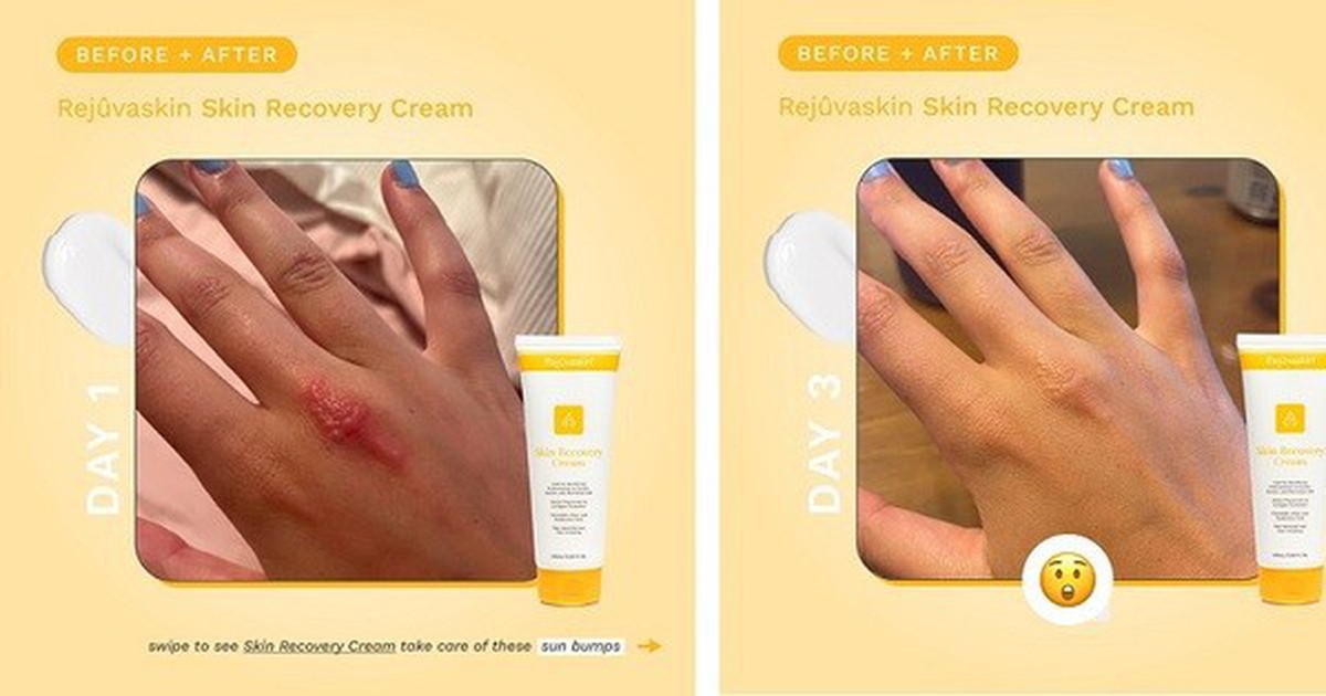 Hướng dẫn sử dụng kem phục hồi Rejuvaskin đúng chuẩn chuyên gia đạt hiệu quả tối đa