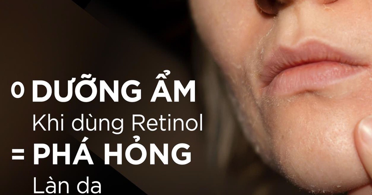 Không dưỡng ẩm khi dùng retinol = ‘phá hỏng’ công trình chăm sóc da