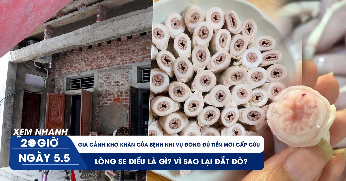Xem nhanh 20h ngày 5.5: Lòng se điếu là gì? | Gia cảnh khó khăn của bệnh nhi vụ đóng đủ tiền mới cấp cứu