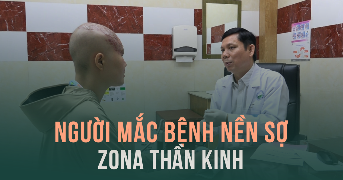 Zona thần kinh: nỗi ám ảnh của người mắc bệnh nền