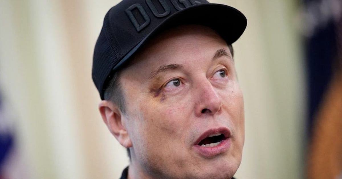 Tỉ phú Musk nói gì về vết bầm trên mắt, cáo buộc dùng ma túy?