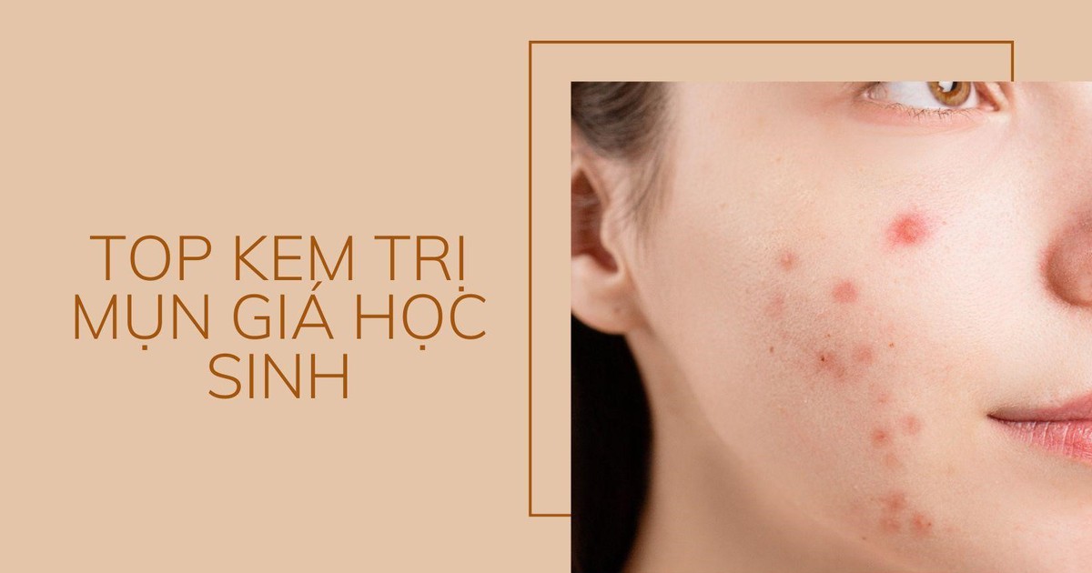 Top 5 kem trị mụn giá học sinh mà chất lượng quốc tế