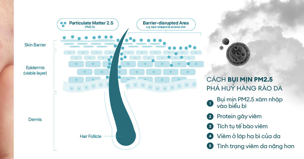 Bảo vệ sức khỏe làn da trước ô nhiễm bụi mịn