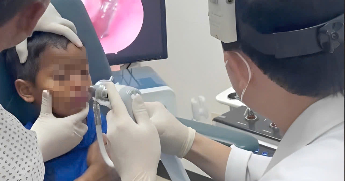 Gắp ra con đỉa sống ký sinh trong mũi bệnh nhi