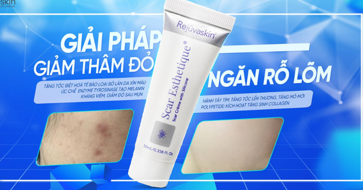 Vai trò các thành phần chống ô xy hóa trong kem trị sẹo thâm
