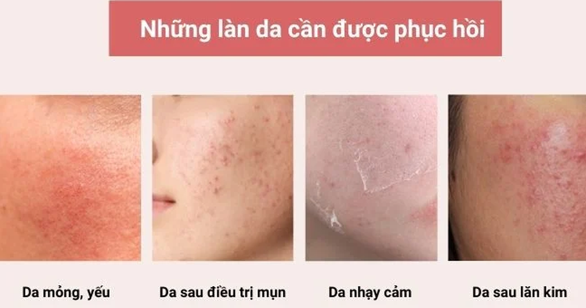Khi nào làn da cần phục hồi?