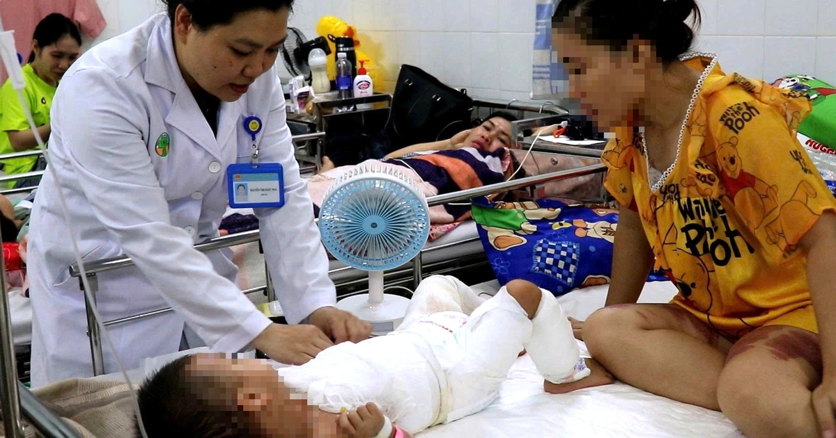 Mẹ hiến da ghép cứu con 2 tuổi bị bỏng nặng do nước sôi