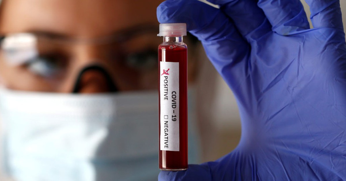 25 bang Mỹ ghi nhận ca Covid-19 tăng, xuất hiện virus kh&aacute;c diễn biến bất thường