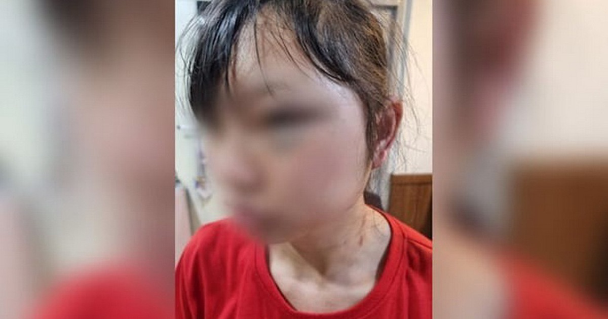 H&agrave;n Quốc tuy&ecirc;n &aacute;n vụ đ&aacute;nh đập th&ocirc; bạo một nữ lao động người Việt