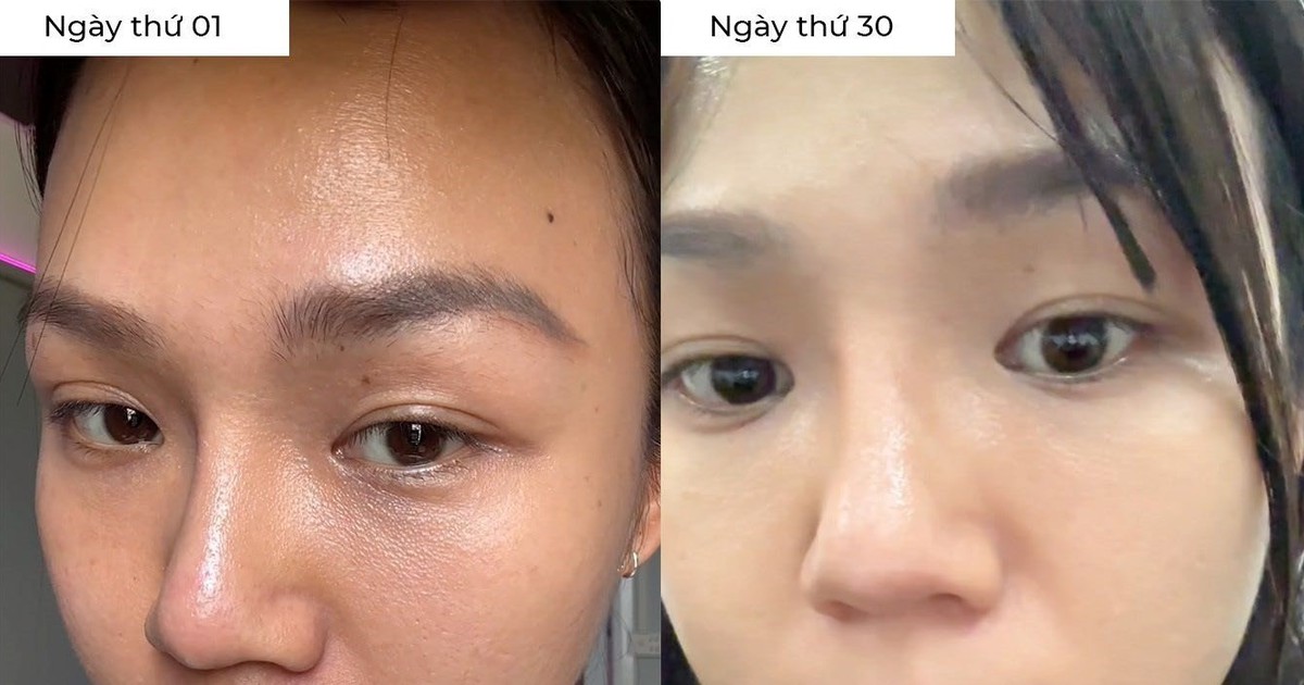 Cảnh báo: Bổ sung collagen sai thời điểm, da không căng trẻ mà còn lão hóa nhanh