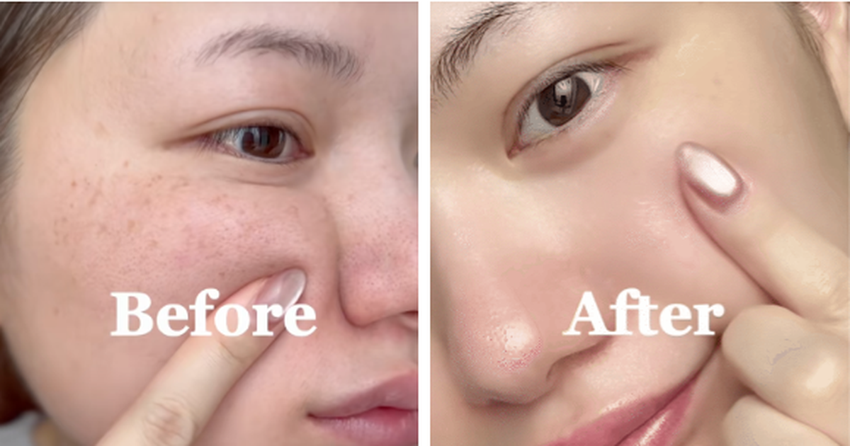 Top 7 serum làm mờ nám đậm, nám sâu tới đâu cũng hiệu quả