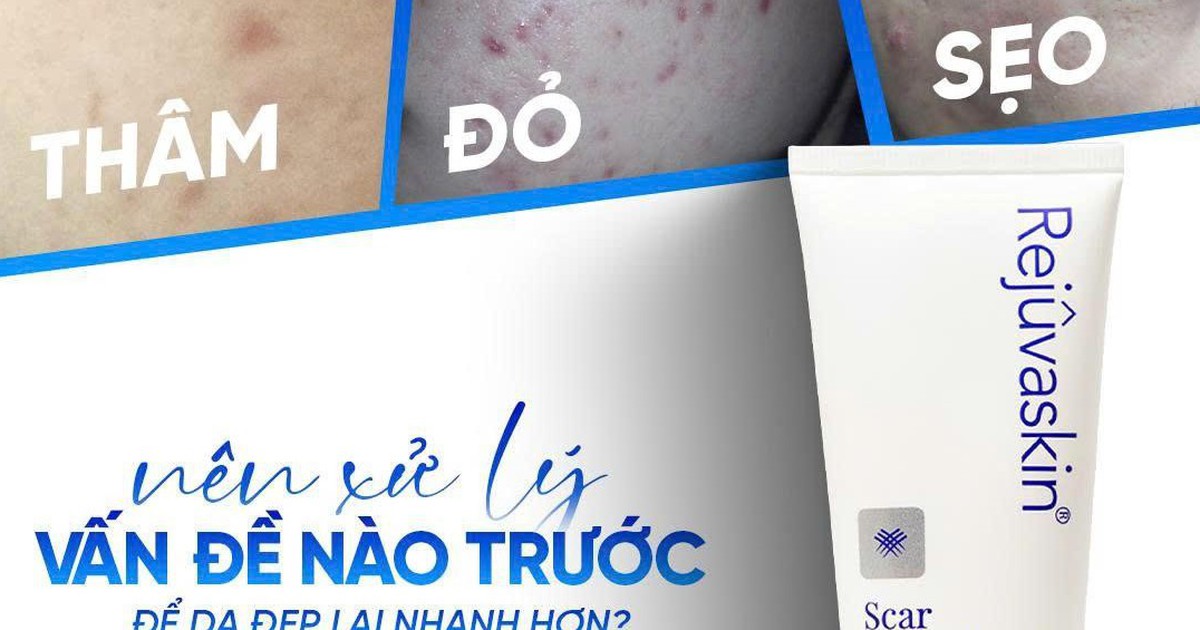 Da mụn breakout: khi nào nên chăm sóc da, khi nào nên đi thẳng đến treatment?