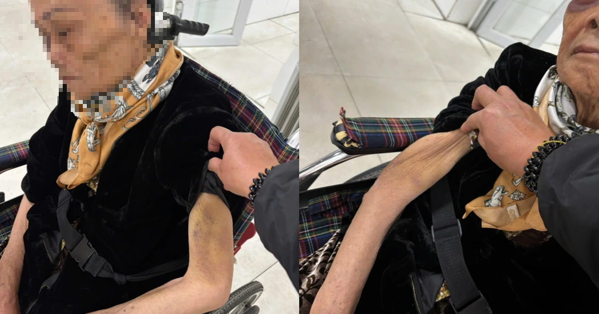 Công an điều tra vụ nữ giúp việc bạo hành cụ bà 82 tuổi ở Hà Nội