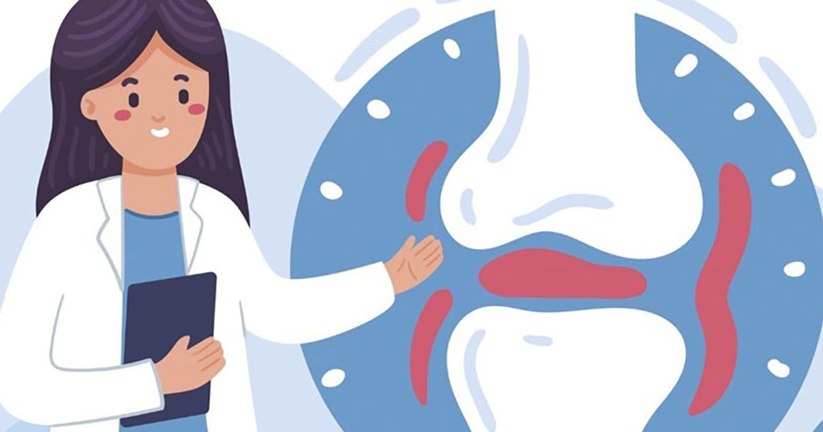 Giải mã chìa khóa bảo vệ sức khỏe cơ xương khớp