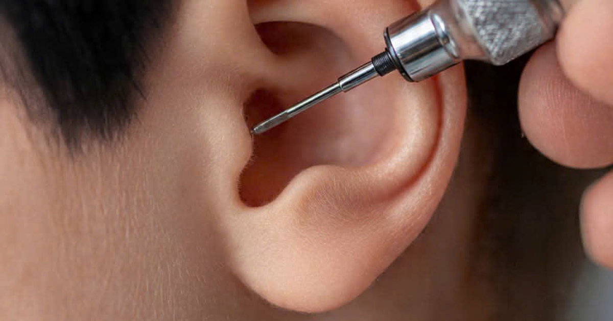 Nội soi tai phải cách nhau 7 ngày mới được bảo hiểm y tế thanh toán?