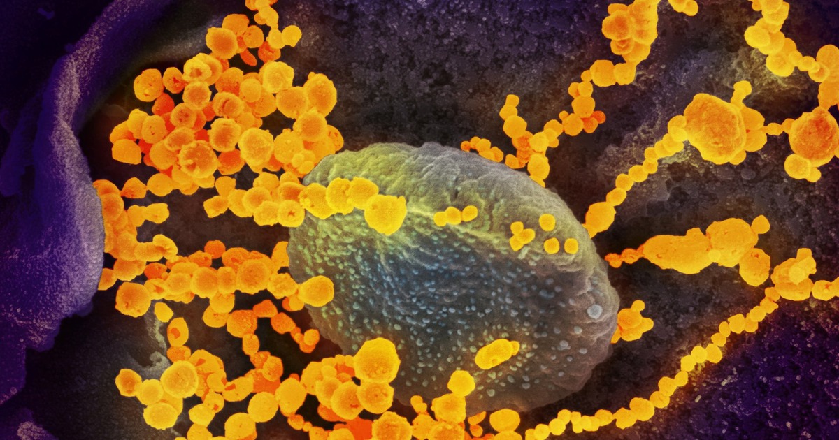 WHO k&ecirc;u gọi Mỹ chia sẻ th&ocirc;ng tin t&igrave;nh b&aacute;o b&iacute; mật về nguồn gốc Covid-19