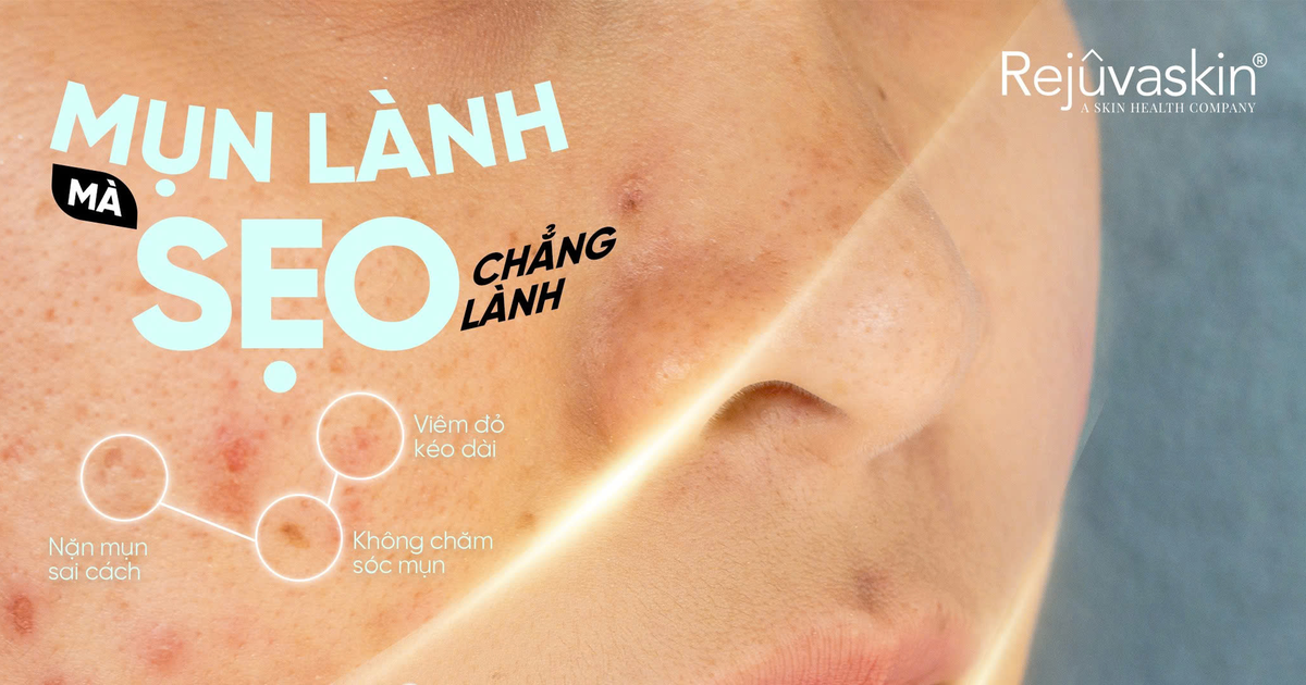 Vì sao da sau mụn dễ thâm và để lại sẹo?