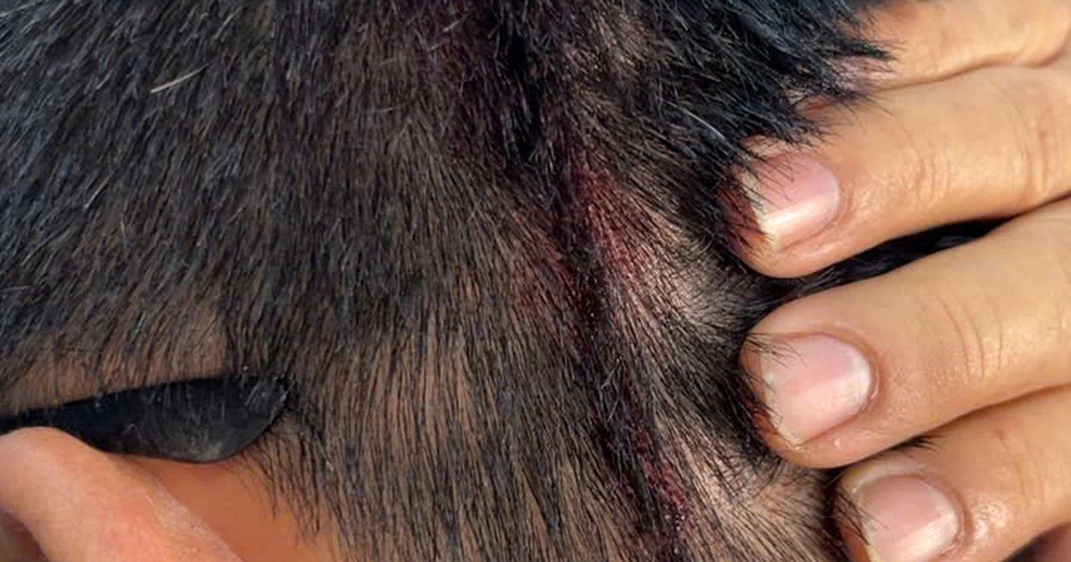 TP.HCM: Điều tra vụ người đàn ông bị hàng xóm tấn công gây thương tích