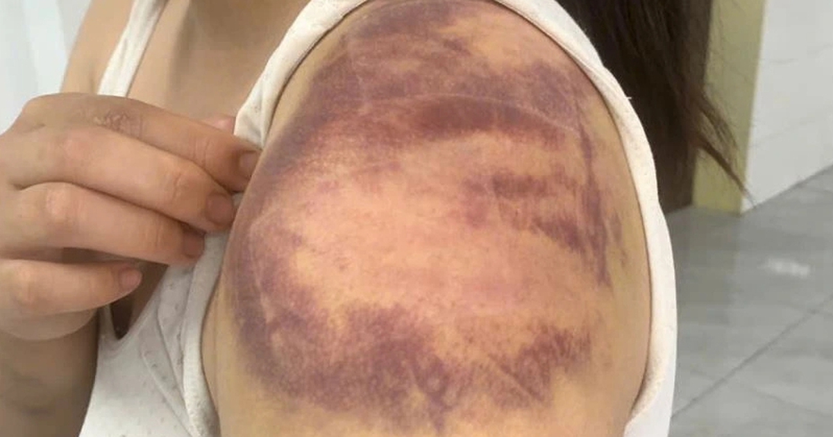 Tạm giữ hình sự đối tượng trói, đánh con ruột, hành hạ vợ mang thai