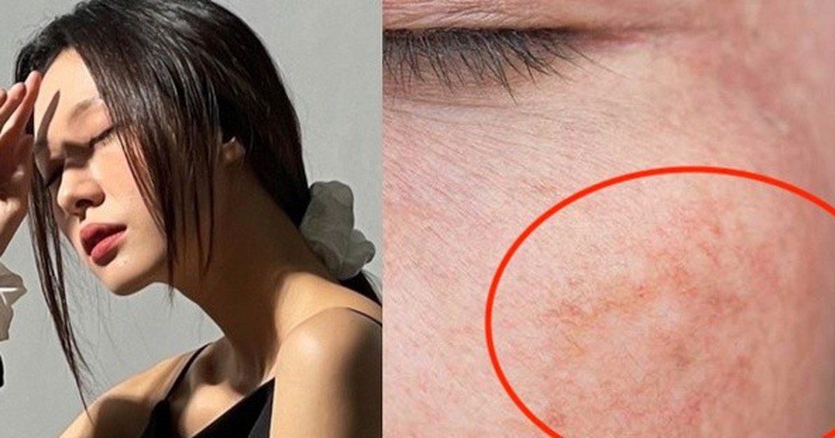 4 serum mờ nám, tàn nhang ai cũng bất ngờ vì hiệu quả với cả chân sâu