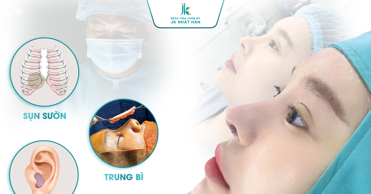 Nâng mũi thuần tự thân, giảm bóng đỏ, lộ sống, không lo sửa nhiều lần