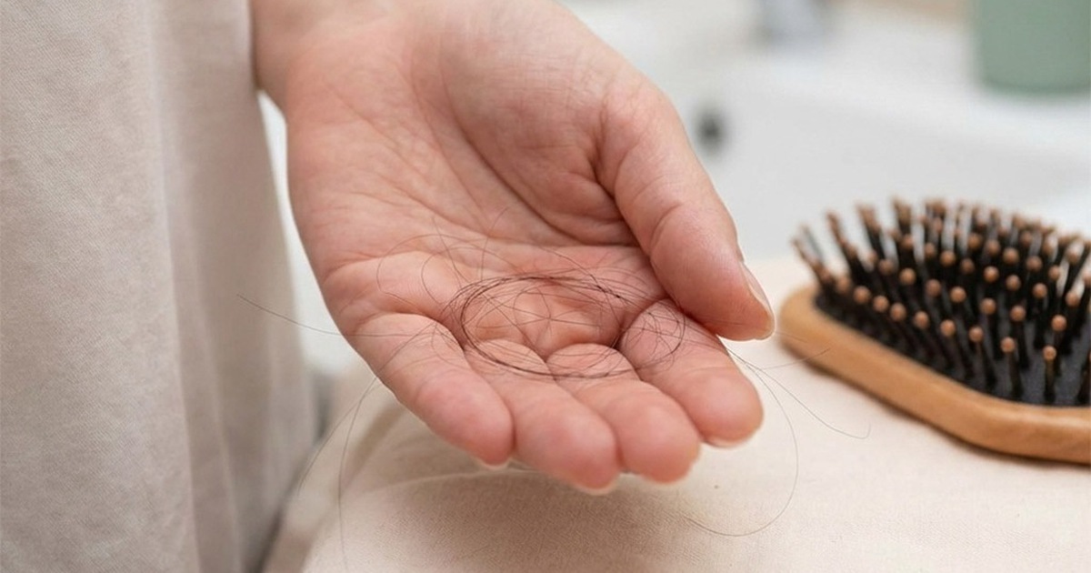 Chuyên gia: Muốn giảm rụng tóc, hãy chú ý những điều sau đây!