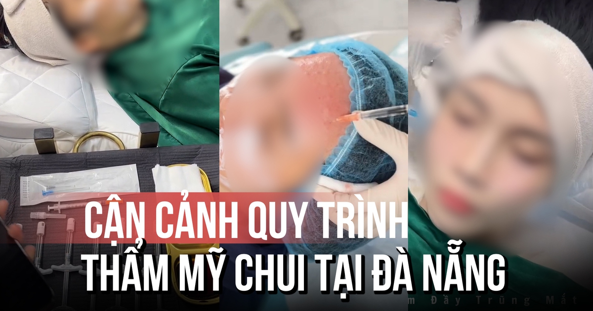 Thẩm mỹ 'chui' bủa vây: Cận cảnh quy trình làm đẹp không phép tại Đà Nẵng