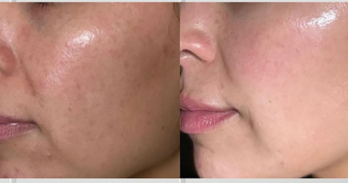 7 kem trắng da chống lão hóa giúp làn da tuổi 40 căng trẻ, mịn màng