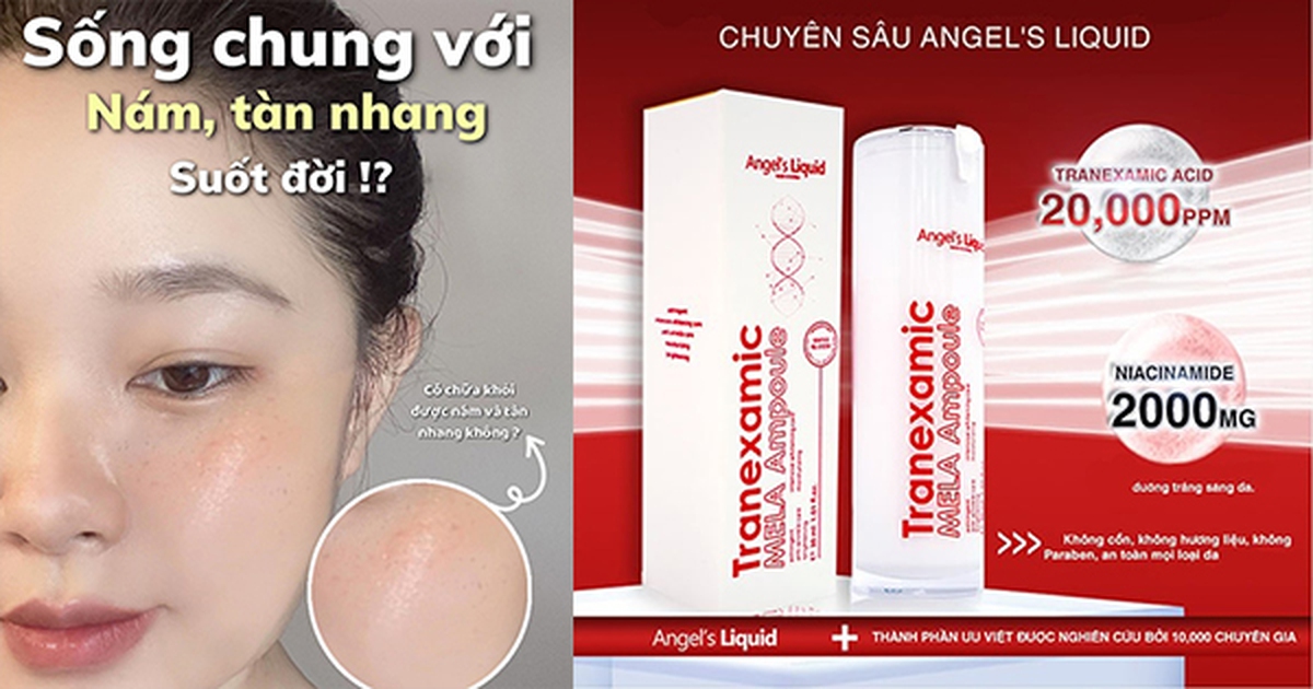 Top 3 serum tranexamic a xít mờ nám từ bên trong, da trắng sáng sau 4 tuần