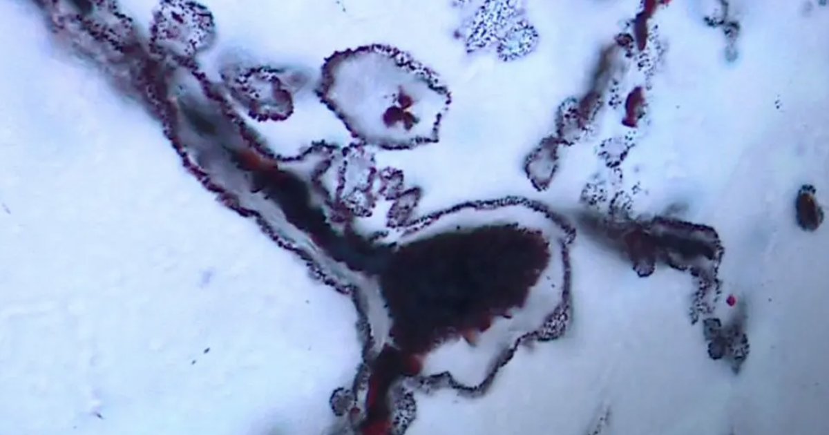 Tìm ra mảnh ghép còn thiếu cho lời giải về nguồn gốc sự sống?