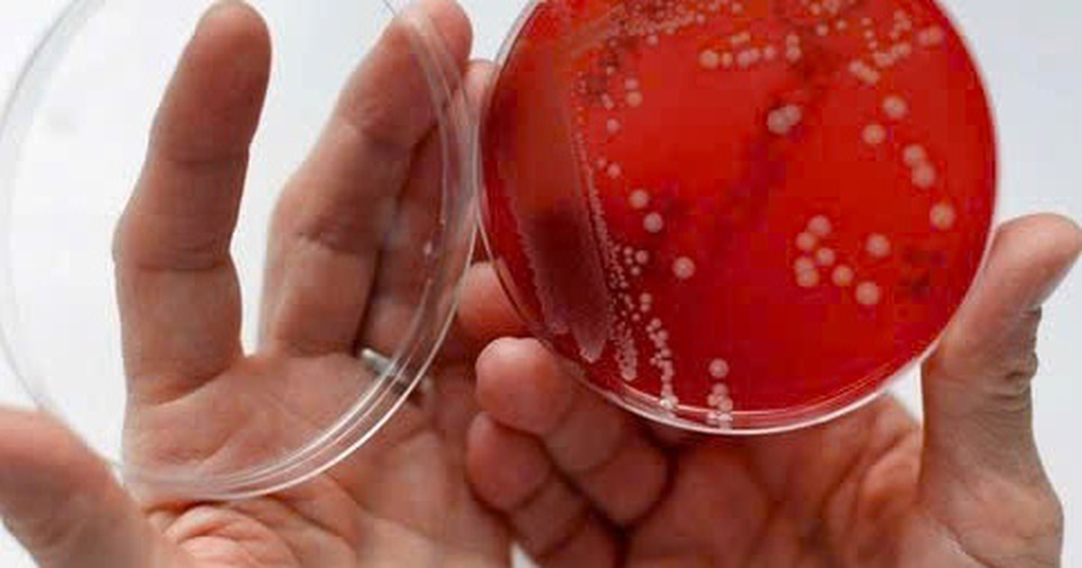 'Siêu vi khuẩn' tấn công não, tim khiến thiếu nữ 16 tuổi nguy kịch