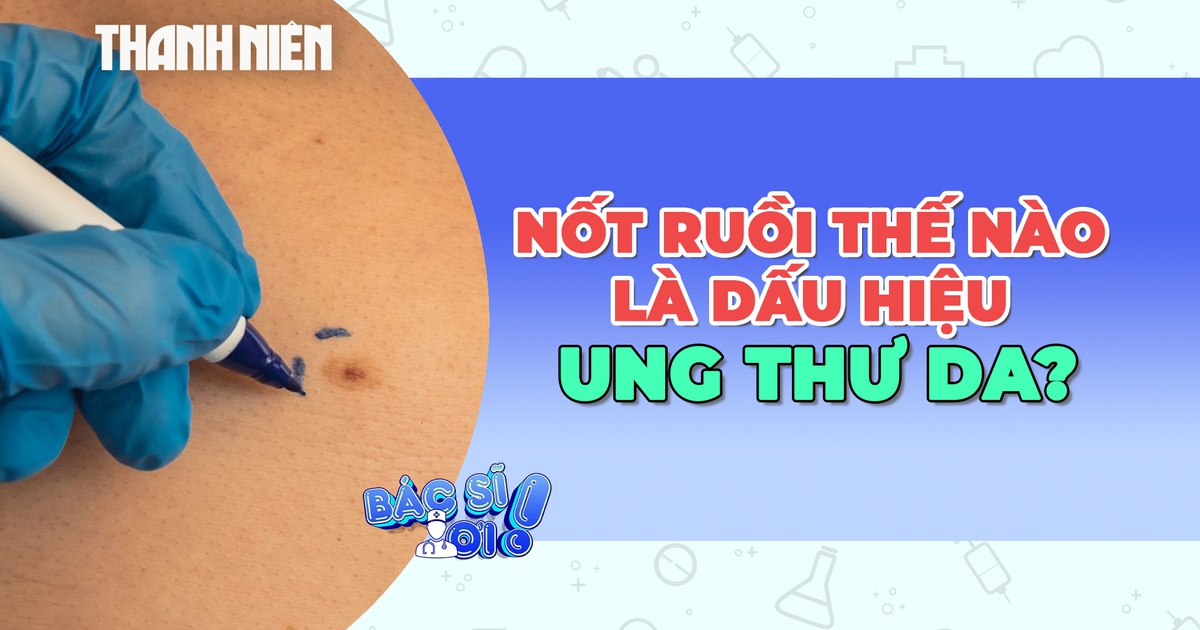 Cảnh báo những nốt ruồi bất thường là dấu hiệu của ung thư da