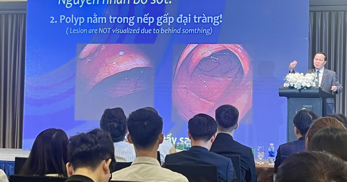 Chuyên gia lưu ý nguy cơ gây ung thư bị bỏ sót trong nội soi tiêu hóa