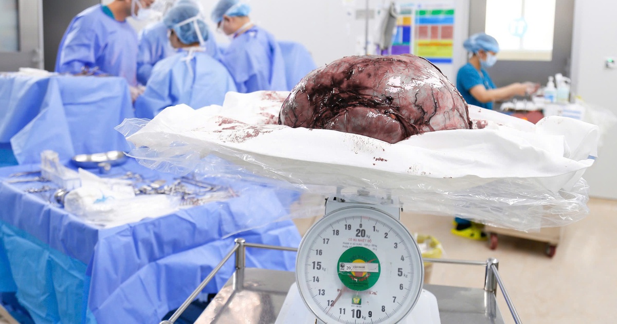 U xơ tử cung 12 kg, to như bụng mang song thai trong người cô gái trẻ