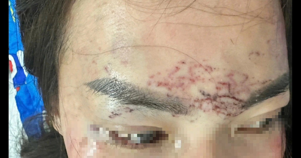 Đánh ghen, xăm lên mặt "tình địch": 2 phụ nữ ở Cà Mau lãnh án tù