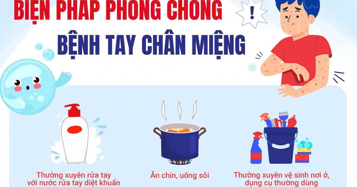 Virus EV71 gây bệnh tay chân miệng có độc lực cao