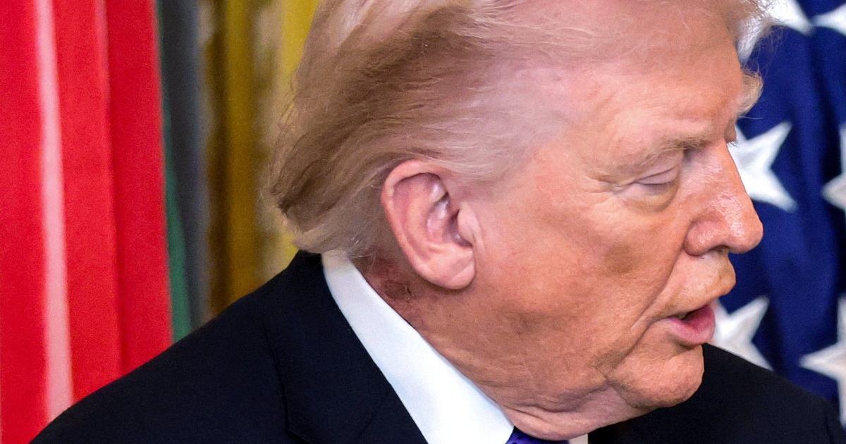 Nhà Trắng lên tiếng về vết đỏ trên cổ Tổng thống Trump - Báo Thanh Niên