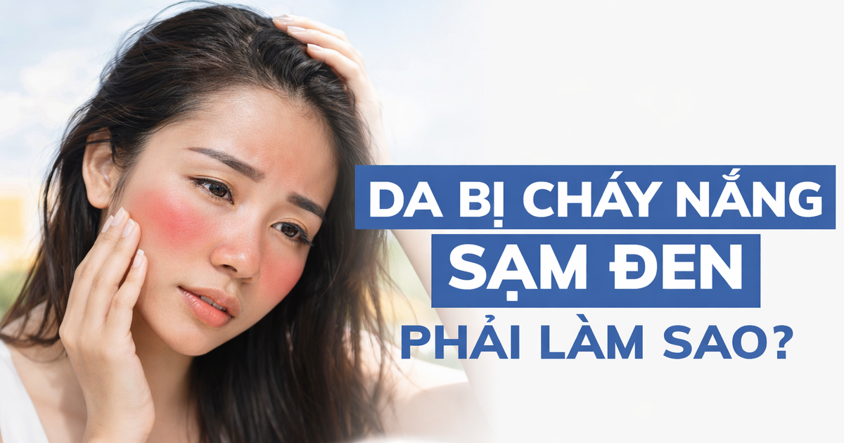 Nắng nóng gần 40 độ: Da bỏng rát, sạm màu? Cách phục hồi sau 1 đêm