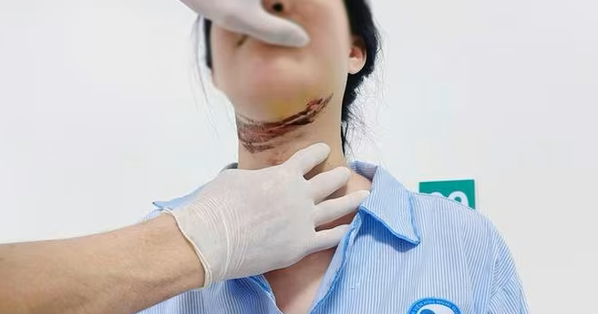 Nữ sinh ở Quảng Trị bị d&acirc;y giăng ngang đường cứa v&agrave;o cổ khi đi học về