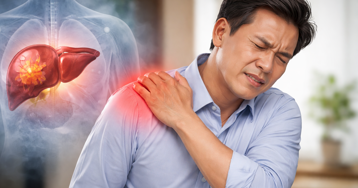Đau vai không rõ nguyên nhân có phải là dấu hiệu của ung thư gan?