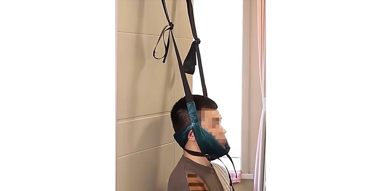 Cảnh báo nguy cơ liệt do tự kéo giãn cột sống cổ