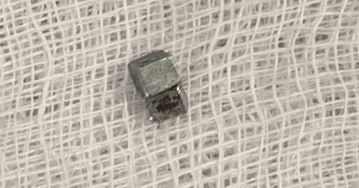 Bé trai 5 tuổi ho, đau họng, đi khám phát hiện nuốt 7 viên nam châm