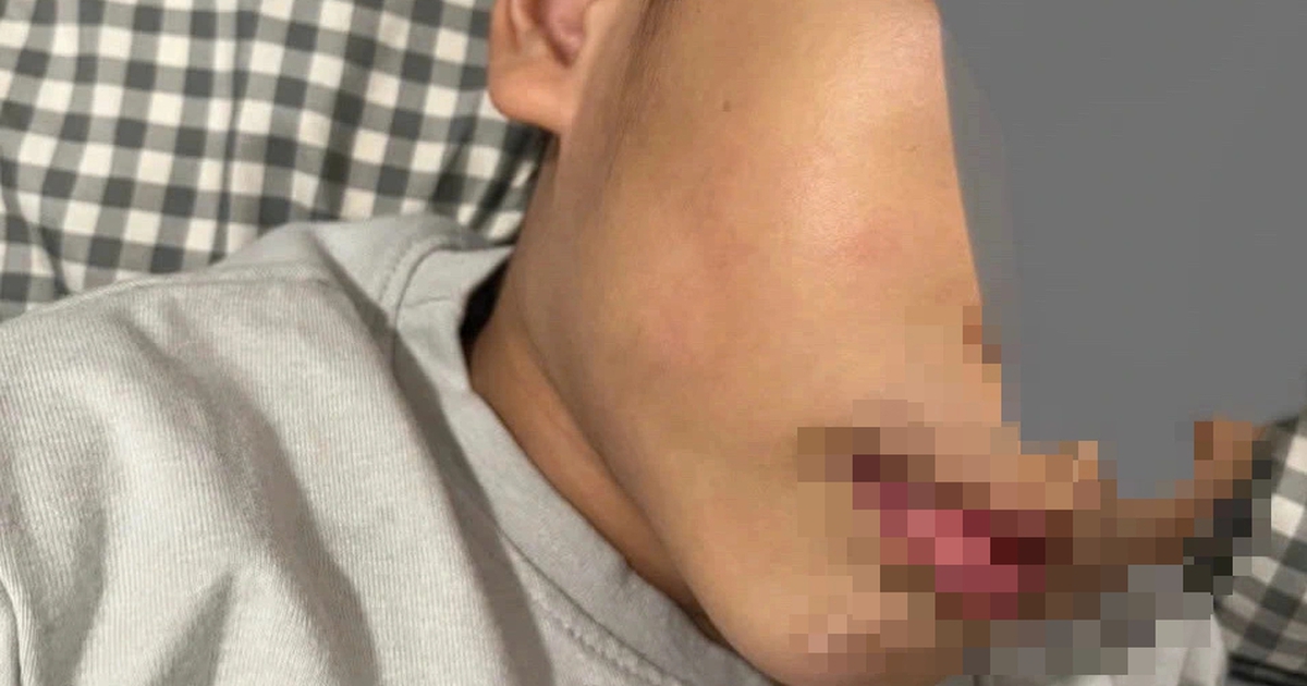 TP.HCM: Trường mầm non Hoa Lư đình chỉ 2 cô có hành vi không chuẩn mực với trẻ