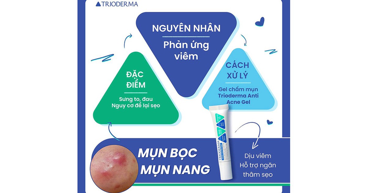 Kem giúp giảm mụn bọc nào đang viral vì hiệu quả sau 4 tuần mà không thâm?