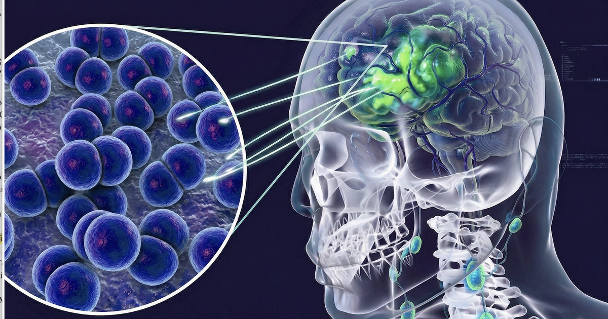 Viêm não mô cầu: Sau ca tử vong, 10 ngày qua Cà Mau chưa có ca mới