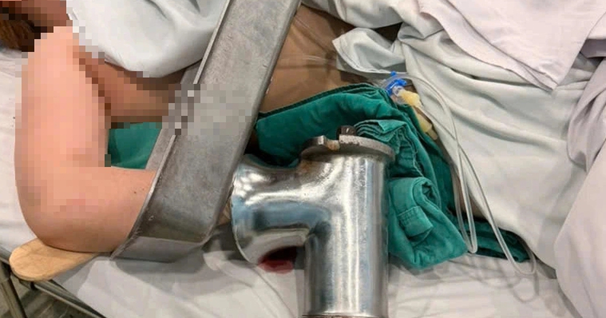 TP.HCM: Người phụ nữ đi cấp cứu với bàn tay phải dính chặt trong máy xay thịt