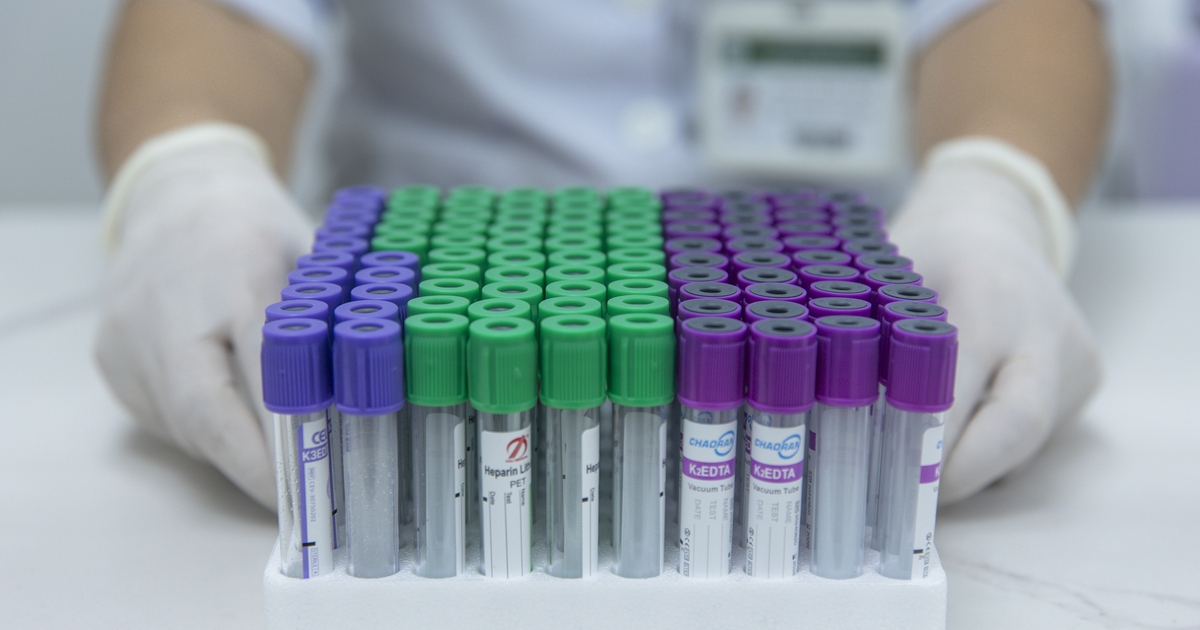 Cần hiểu đúng về xét nghiệm máu chẩn đoán ung thư