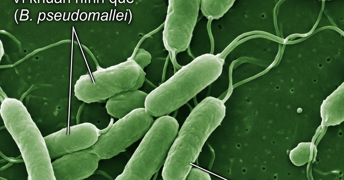 Bệnh 'sốt đất' đang lan rộng ở Thái Lan là bệnh gì?