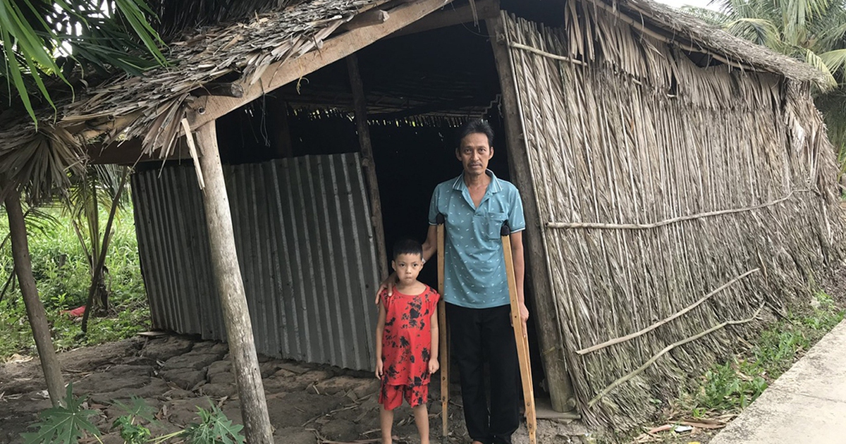 Bị hoại tử chỏm xương đùi, người đàn ông nghèo mong được giúp đỡ